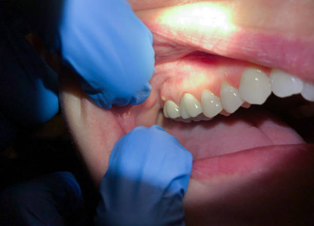 Best 24-Hour Emergency Dentist in Maryville, MO